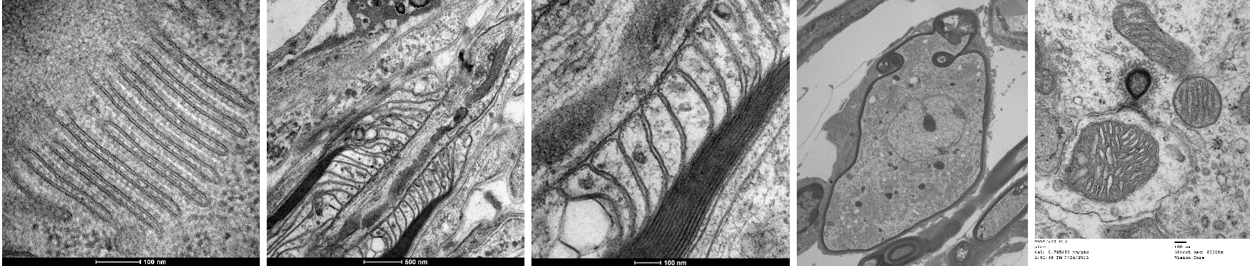 fig5 ex TEM2