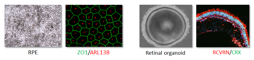 figure RPE organoides